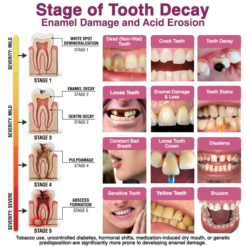 Kervalon® DenPerm Cavity-Repair Natural Enamel Filling Gel