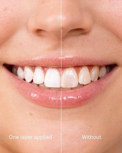 Kervalon® SmileBrilliant Tooth Polish