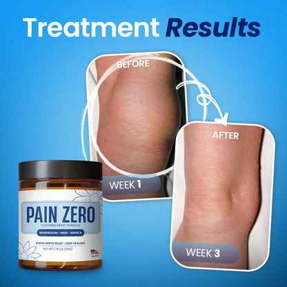 Kervalon® Pain Zero Magnesium Formula✨