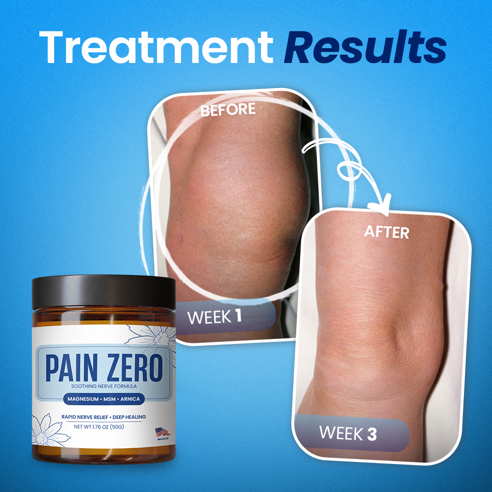 Kervalon® Pain Zero Magnesium Total Relief Cream