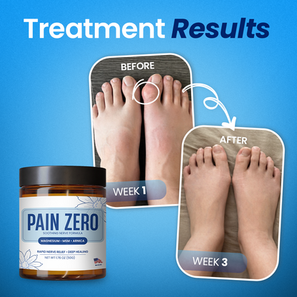 Kervalon® Pain Zero Magnesium Total Relief Cream