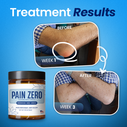soft Kervalon® Pain Zero Magnesium Relief Cream