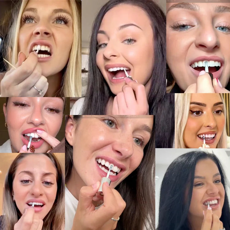 Kervalon® SmileBrilliant Tooth Polish